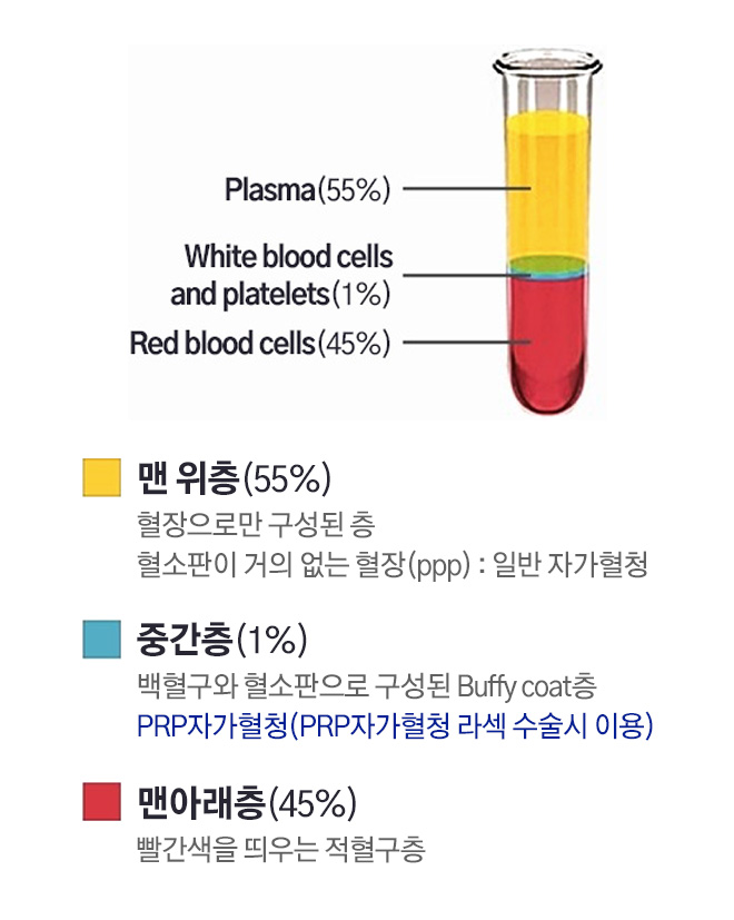 맨 위층(55%) - 혈장으로만 구성된 층, 혈소판이 거의 없는 혈장(ppp) : 일반 자가혈청 / 중간층(1%) - 백혈구와 혈소판으로 구성된 Buffy coat층, PRP자가혈청(PRP자가혈청 라섹 수술시 이용) / 맨아래층(45%) - 빨간색을 띄우는 적혈구층